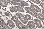 ATR Antibody in Immunohistochemistry (Paraffin) (IHC (P))