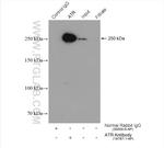 ATR Antibody in Immunoprecipitation (IP)