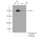 ATR Antibody in Immunoprecipitation (IP)