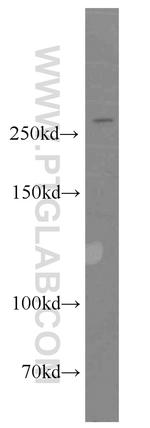 ATR Antibody in Western Blot (WB)