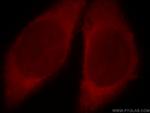 Catalase Antibody in Immunocytochemistry (ICC/IF)