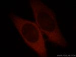 Catalase Antibody in Immunocytochemistry (ICC/IF)