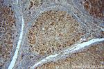 Catalase Antibody in Immunohistochemistry (Paraffin) (IHC (P))