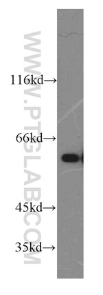 Catalase Antibody in Western Blot (WB)