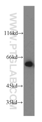 Catalase Antibody in Western Blot (WB)