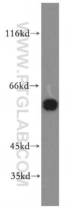 Catalase Antibody in Western Blot (WB)