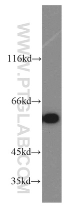 CCT6A Antibody in Western Blot (WB)