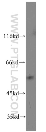 CCT6A Antibody in Western Blot (WB)