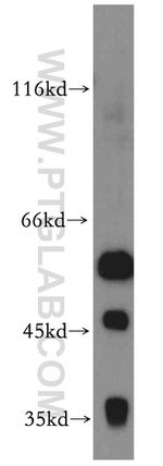 CCT6A Antibody in Western Blot (WB)