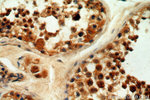 THUMPD3 Antibody in Immunohistochemistry (Paraffin) (IHC (P))