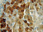 THUMPD3 Antibody in Immunohistochemistry (Paraffin) (IHC (P))