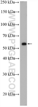 THUMPD3 Antibody in Western Blot (WB)