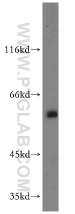 THUMPD3 Antibody in Western Blot (WB)