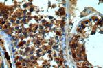 DHX32 Antibody in Immunohistochemistry (Paraffin) (IHC (P))