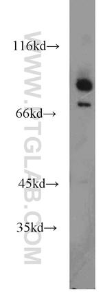 DHX32 Antibody in Western Blot (WB)