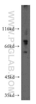 DHX32 Antibody in Western Blot (WB)