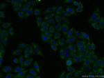 RtcB Antibody in Immunocytochemistry (ICC/IF)