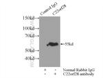 RtcB Antibody in Immunoprecipitation (IP)