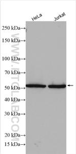 RtcB Antibody in Western Blot (WB)