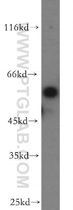 RtcB Antibody in Western Blot (WB)