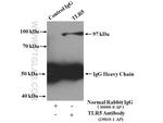 TLR5 Antibody in Immunoprecipitation (IP)