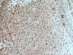 TLR4 Antibody in Immunohistochemistry (Paraffin) (IHC (P))