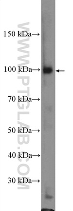 TLR4 Antibody in Western Blot (WB)