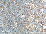 TLR1 Antibody in Immunohistochemistry (Paraffin) (IHC (P))