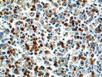 TLR1 Antibody in Immunohistochemistry (Paraffin) (IHC (P))