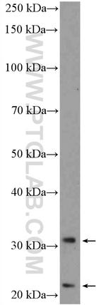 TMEM176B Antibody in Western Blot (WB)