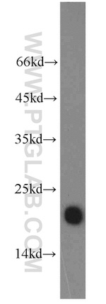 TMEM176B Antibody in Western Blot (WB)