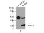 HADH Antibody in Immunoprecipitation (IP)