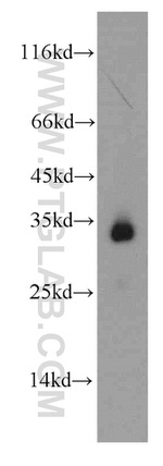 HADH Antibody in Western Blot (WB)