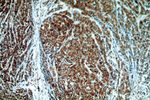 TXNDC5 Antibody in Immunohistochemistry (Paraffin) (IHC (P))