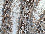 TXNDC5 Antibody in Immunohistochemistry (Paraffin) (IHC (P))