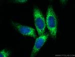 KTN1 Antibody in Immunocytochemistry (ICC/IF)