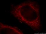 KTN1 Antibody in Immunocytochemistry (ICC/IF)