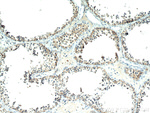 KTN1 Antibody in Immunohistochemistry (Paraffin) (IHC (P))