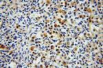 KTN1 Antibody in Immunohistochemistry (Paraffin) (IHC (P))