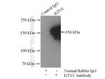 KTN1 Antibody in Immunoprecipitation (IP)