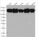 KTN1 Antibody in Western Blot (WB)