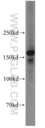 KTN1 Antibody in Western Blot (WB)