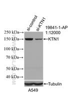 KTN1 Antibody in Western Blot (WB)