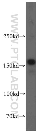 KTN1 Antibody in Western Blot (WB)