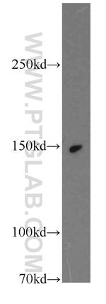 KTN1 Antibody in Western Blot (WB)