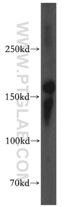 KTN1 Antibody in Western Blot (WB)