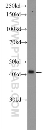 hIST1 Antibody in Western Blot (WB)