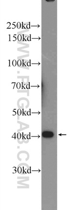 hIST1 Antibody in Western Blot (WB)