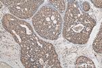 C14orf166 Antibody in Immunohistochemistry (Paraffin) (IHC (P))