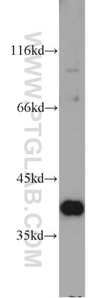 TMEM173/STING Antibody in Western Blot (WB)